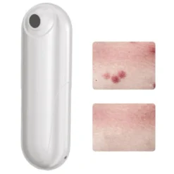 Clearance Bugbett Klåda Relief Tool USB Uppladdningsbart myggbettssug Kemikaliefritt för insektsbett Bigetingstick Insektmiddel & Dyreafvisende Middel